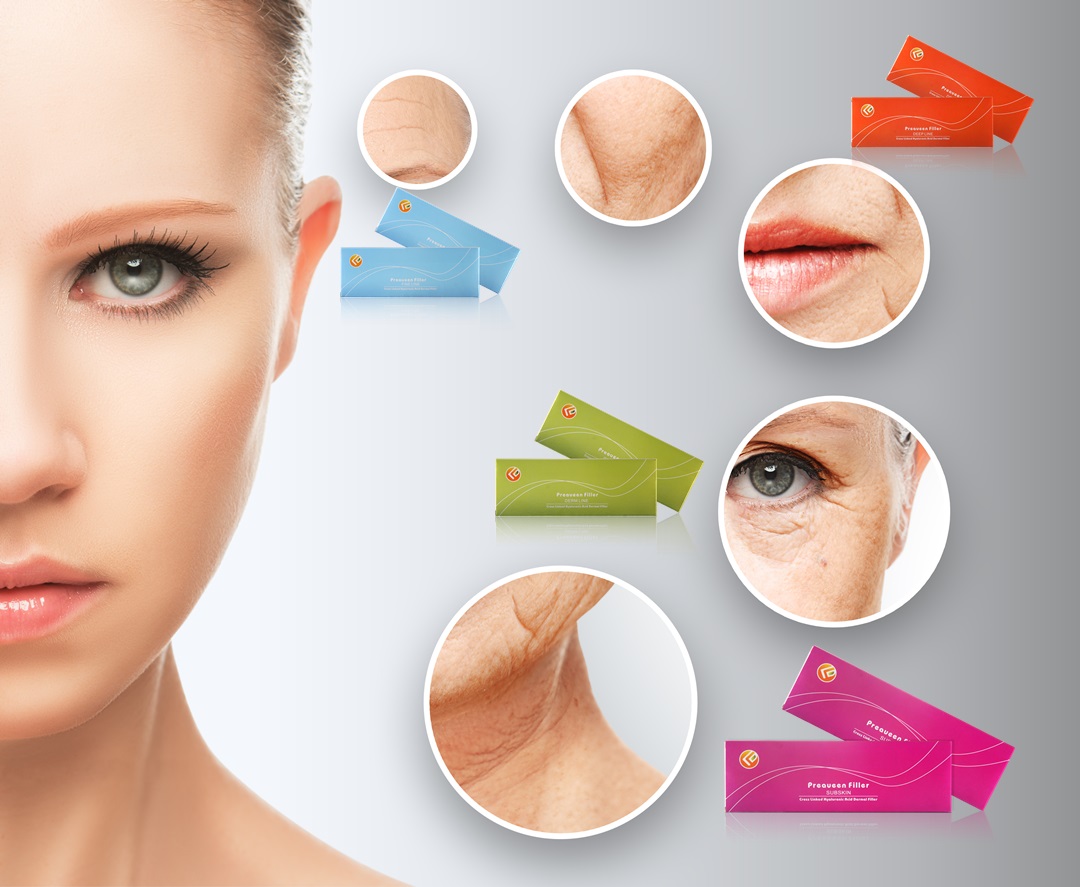 Do you know what are differences between different types of hyaluronic acid fillers?