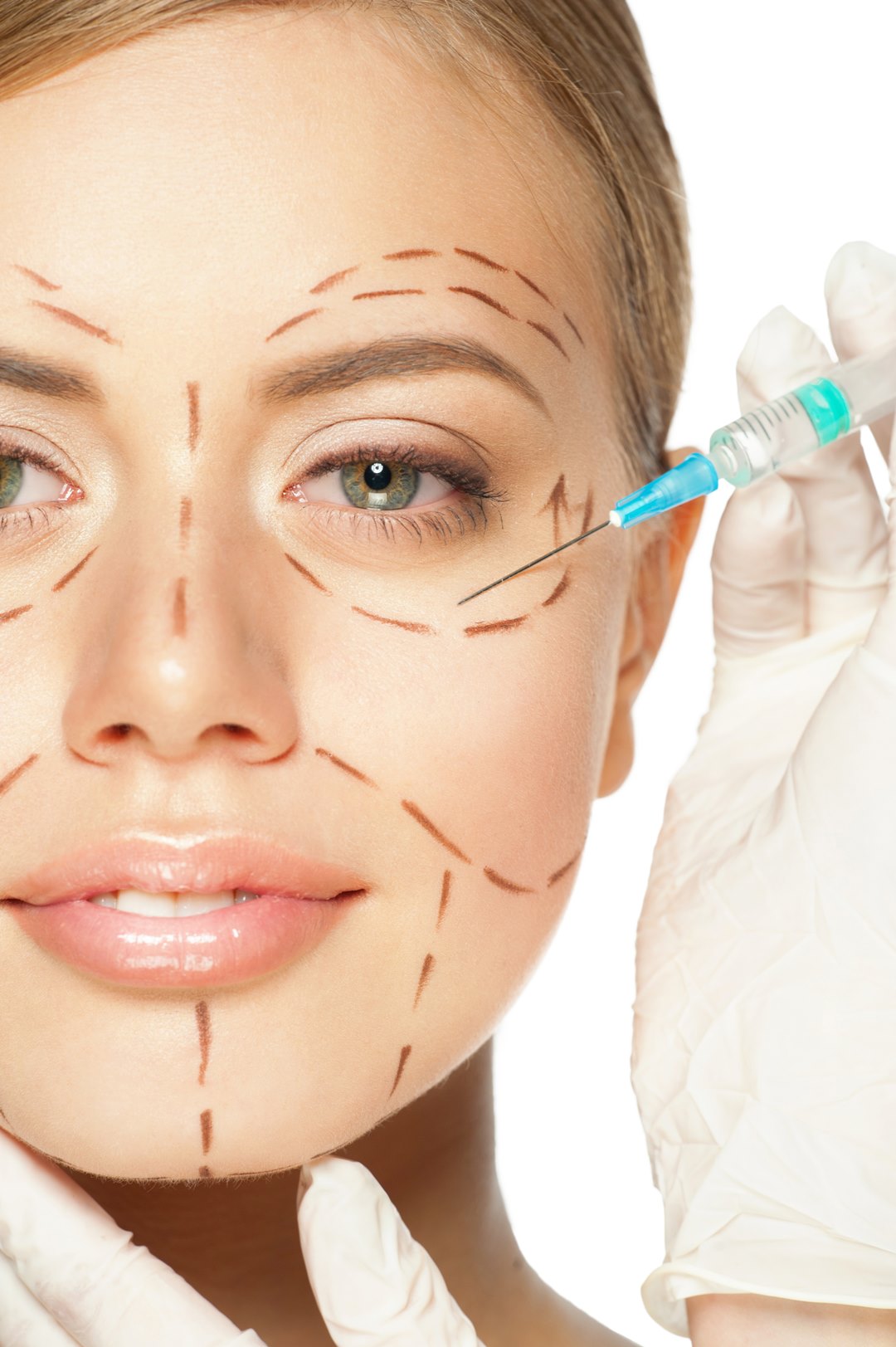 What exactly are hyaluronic acid dermal fillers?Do dermal fillers really work?